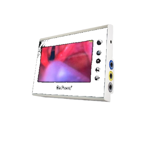 Pantalla OnFocus Advanced